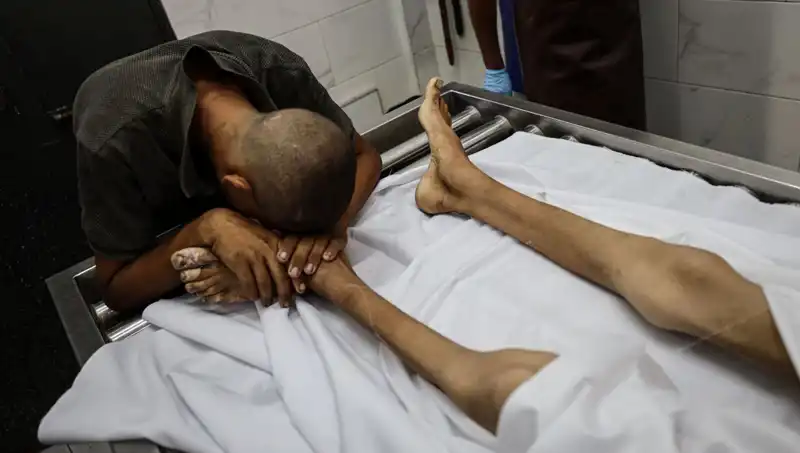 Gazze'de Açlık Faciası: Bir Çocuk Daha Hayata Veda Etti