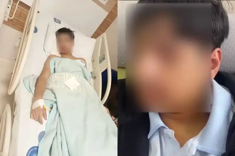 Antalya'da Akran Zorbalığı: Arkadaşının Çenesini Kıran Genç Şokta